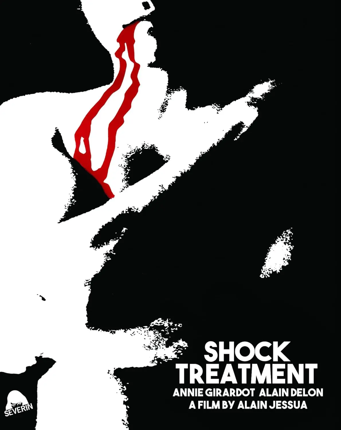Shock Treatment [Bluray] 1